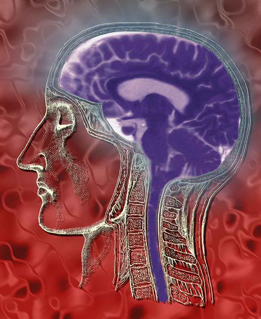 The Correlation Between 18-Wheeler Truck Wrecks and Traumatic Brain